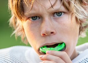 Sports Mouth Guards Dentist Grand Rapids Sports Mouthguards Dentist Grand Rapids